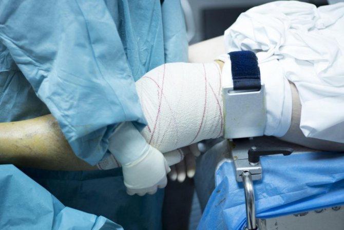 Артроскопия коленного сустава в Челябинске thumbnail